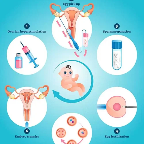 Οδηγός Εξωσωματικής